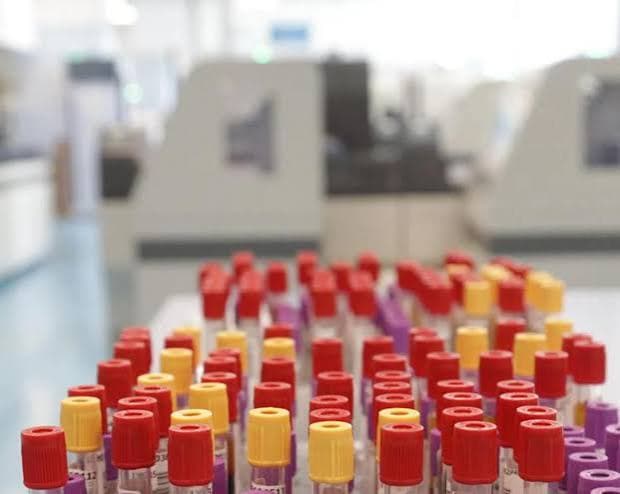 A Francoforte, i casi di malaria salgono a otto: tre morti nella zona dell'aeroporto